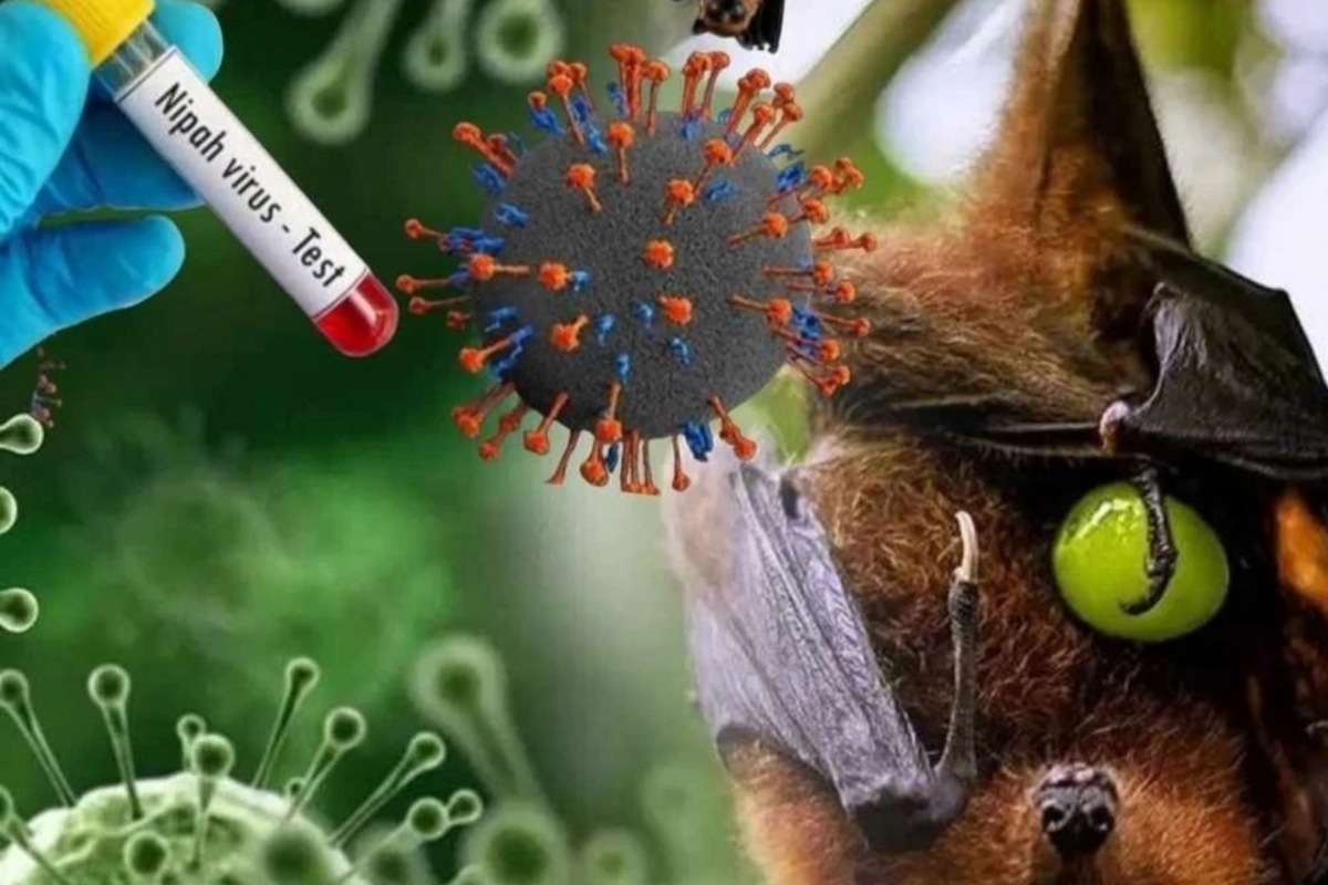 Virus Nipah gây viêm màng não, có hệ số lây nhiễm thấp hơn Covid-19